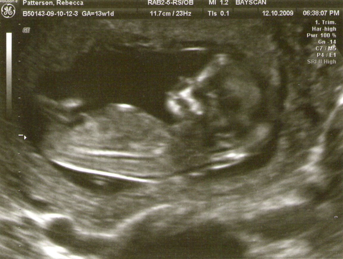 12 week scan. 12 weeks + 5 days pregnant | The Mummy Diaries